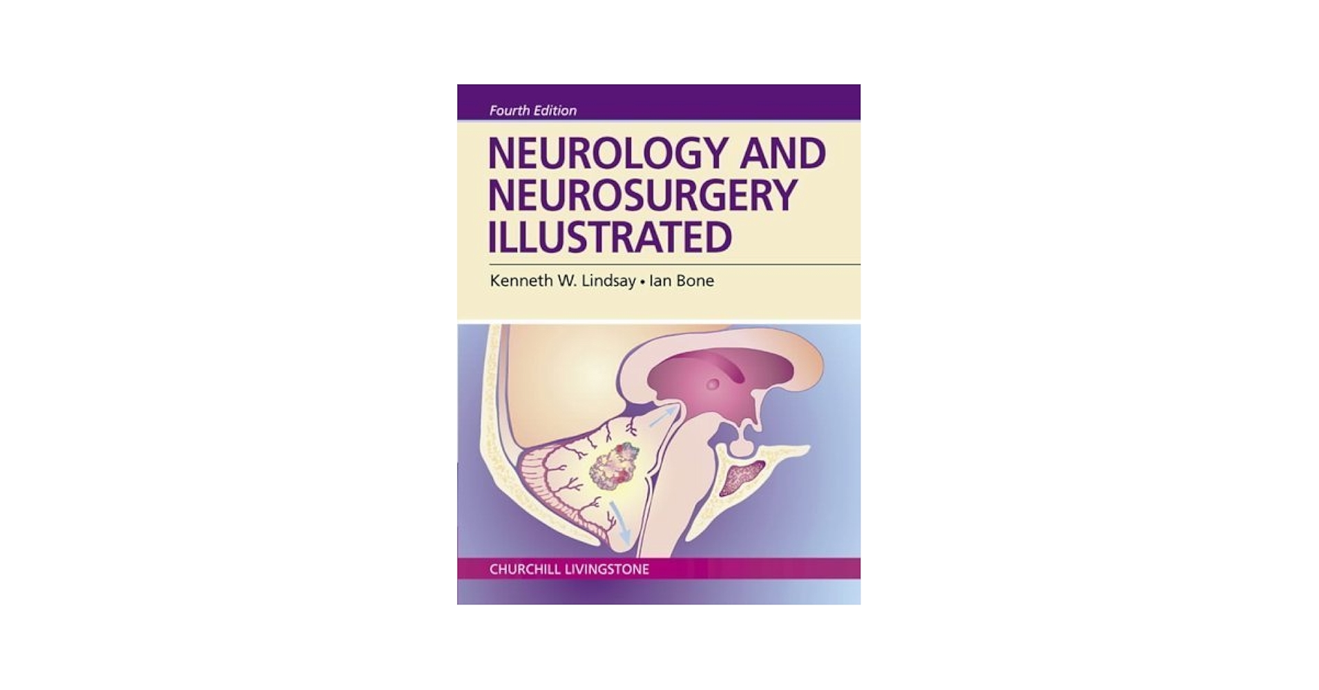 Microneurosurgery 4B ⅣB Neurology and Neurosurgery Illustrated 4th edition by